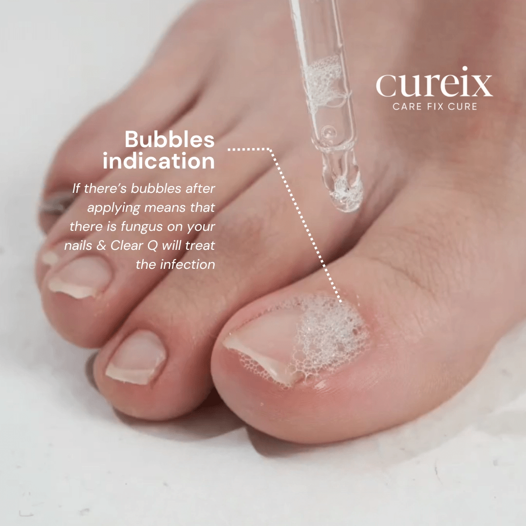 Cureix Clear Q (15ml) - Image 4
